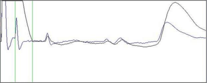 TDR-kurve-pulsbredder